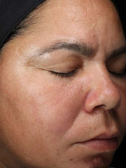 Image of face before using product